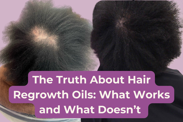 The Truth About Hair Regrowth Oils: What Works and What Doesn’t?