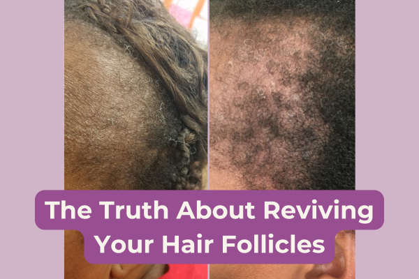 Dormant or Dead? The Truth About Reviving Your Hair Follicles